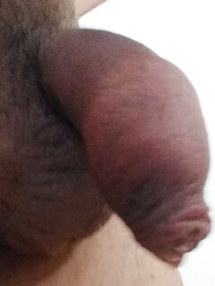 Timido Giovane (piccolo pene?)