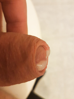 Il mio pisello