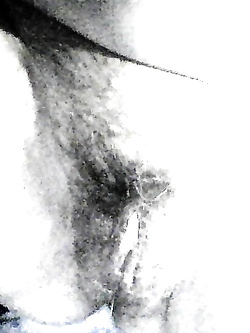 coccole
