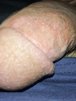 Pruno