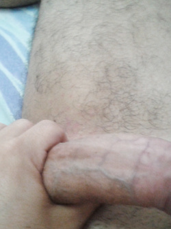 duro20