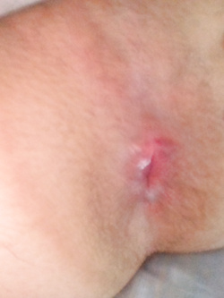 Il mio culo caldo