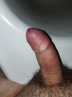 Pisellone Parte 3