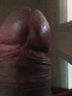 X voi