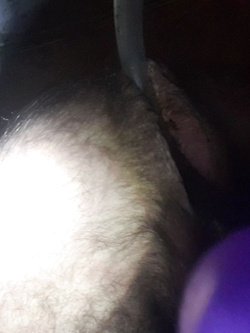 Dilatazione Parte 2