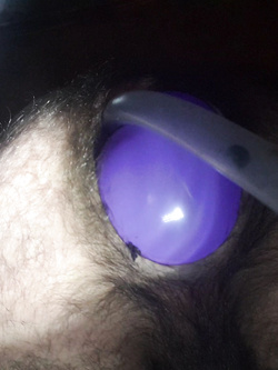 Dilatazione Parte 2
