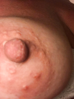 Capezzoli da succhiare