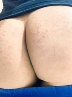 Culetto Parte 5