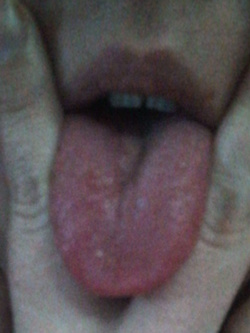 Lolaa