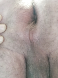 Foto miste