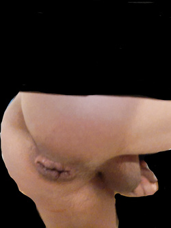 culo rotto Parte 3