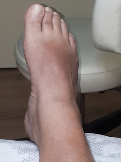 Piede...