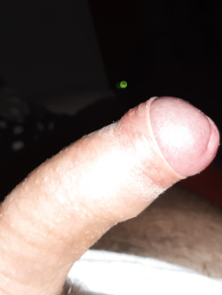 Voglia di un buco