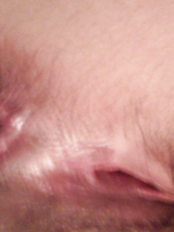 Foto_A