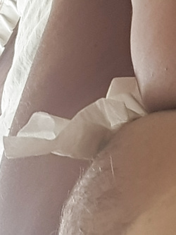 Pulizia fica