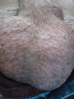 Eccomi Parte 21