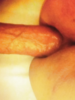 Pompino 1