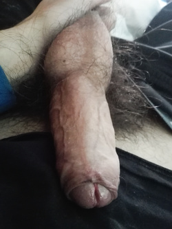 Eccitato Parte 2