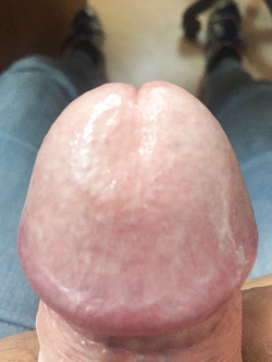 Il mio Pisello Parte 2