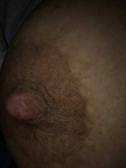 Noi due Parte 44