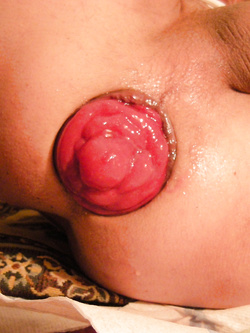 roselline ,rose , o prolassi... come volete voi....:)