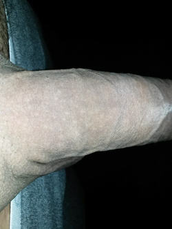 Depilazione primaverile