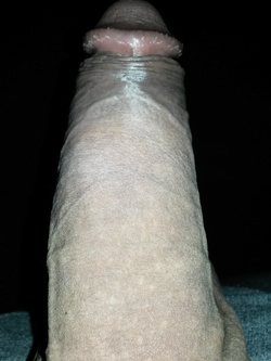 Depilazione primaverile