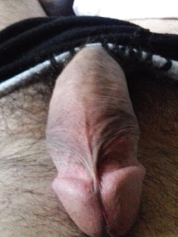 Max71 Parte 11
