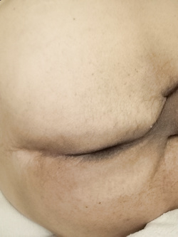 Il lato B.