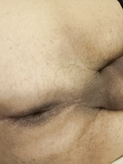 Il lato B.