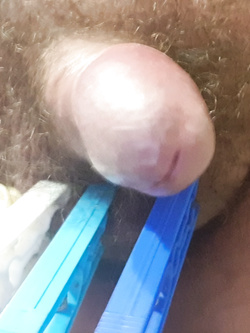 Scappellato matto