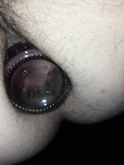 anale Parte 2