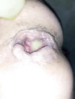 fukme