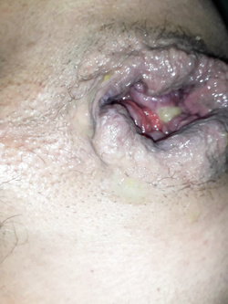 fukme