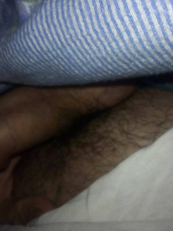 x voi Parte 2