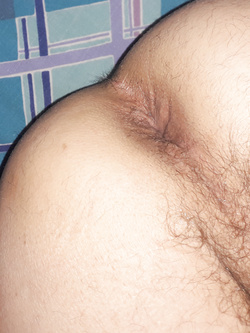 Self ass