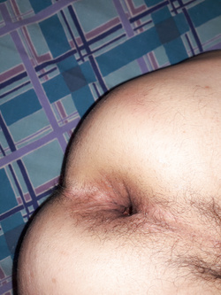 anal 5