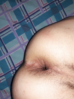 anal 5