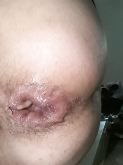 self ass Parte 4