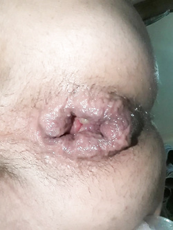 self ass Parte 4