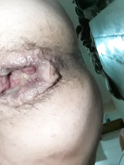 vagin ass