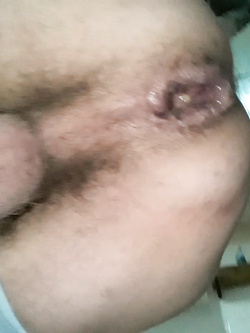 vagin ass