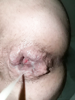 anal cum