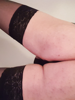 Il mio culetto
