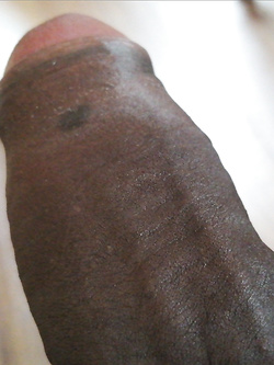 Black Parte 8