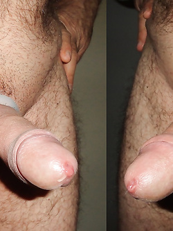 MY ELASTIC RINGS