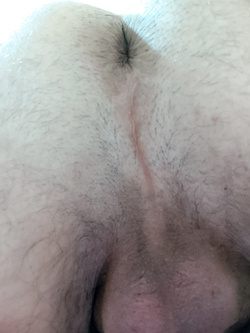 Il mio intimo