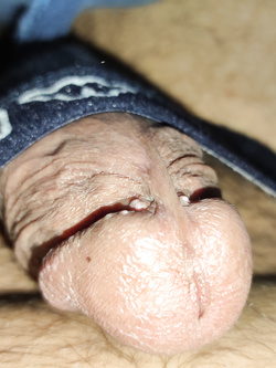 Escilo dalla mutande