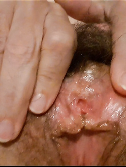 Mia moglie viene visitata da un dottore