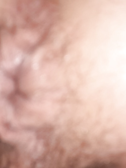anal3